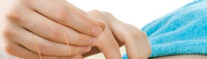 Close up of hands and acupuncture needles being inserted into skin on a back